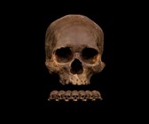 Human Skull Chocolates