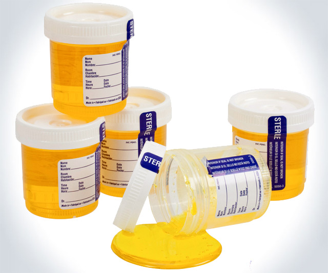 Tower of Sour Candy Urine Samples
