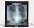 X-Ray Lightbox - Internal Medicine