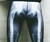 X-Ray Leggings