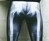 X-Ray Leggings