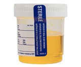 Tower of Sour Candy Urine Sample - Closeup