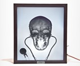 X-Ray Lightbox - Doctor Feelgood