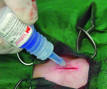 3M Vetbond Tissue Adhesive
