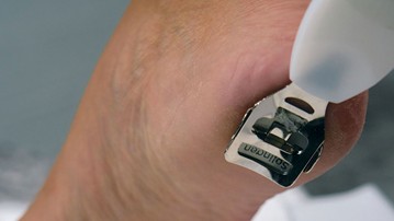 Callus Shaver