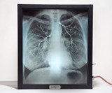 X-Ray Lightbox - Internal Medicine