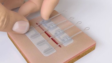 ZipStitch - Close Wounds Without Stitches ZipStitch - Close Wounds Without Stitches