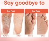 Baby Foot Human Molting Peel