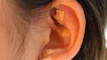 Anxiety Ear Seed Kit Anxiety Ear Seed Kit