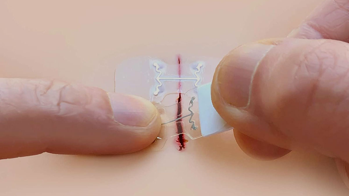 microMend Emergency Wound Closures microMend Emergency Wound Closures