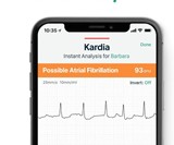 AliveCor KardiaMobile Personal EKG