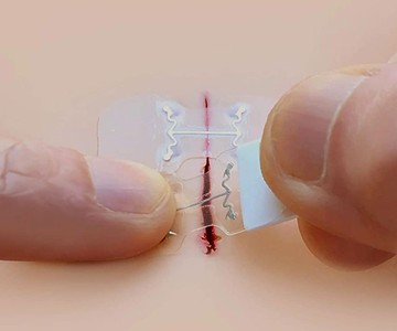 microMend Emergency Wound Closures microMend Emergency Wound Closures