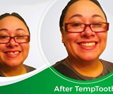 Temptooth Temporary Tooth Replacement Kit