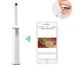 ScopeAround Pore & Intraoral Inspection Camera