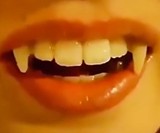 Retractable Vampire Fangs