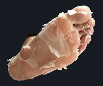 Human Molting Peel Human Molting Peel