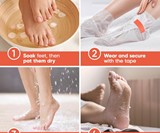 Baby Foot Human Molting Peel