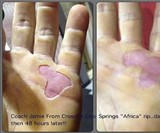 RipFix Hand Tear Repair