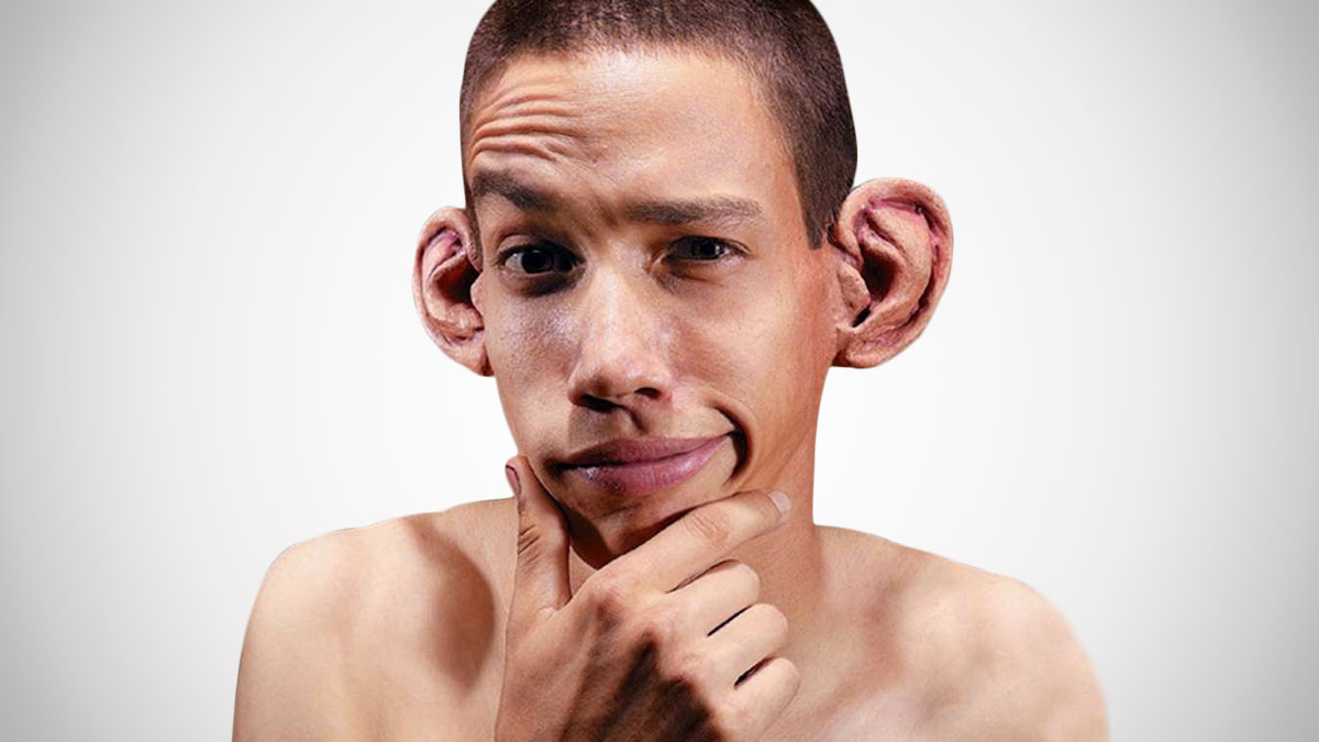 Self Defense UFC Ears Self Defense UFC Ears