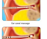 Ear Wax Cleaner Tool Set