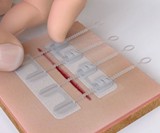 ZipStitch - Close Wounds Without Stitches