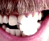 CrossFloss Hands-Free Flossing Tool