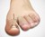 Ingrown Toenail Correction Tool
