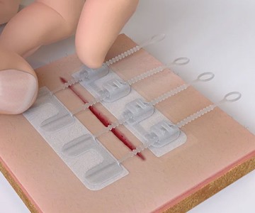 ZipStitch - Close Wounds Without Stitches ZipStitch - Close Wounds Without Stitches