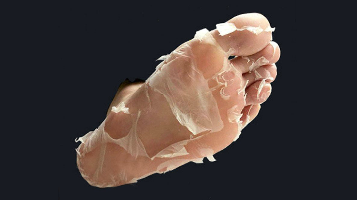 Baby Foot Human Molting Peel Baby Foot Human Molting Peel