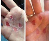 RipFix Hand Tear Repair