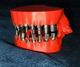 Denture Screw & Drill Bit Holder