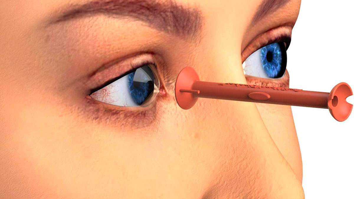 OptiWand Pincher Contact Lens Insertion & Removal Tool