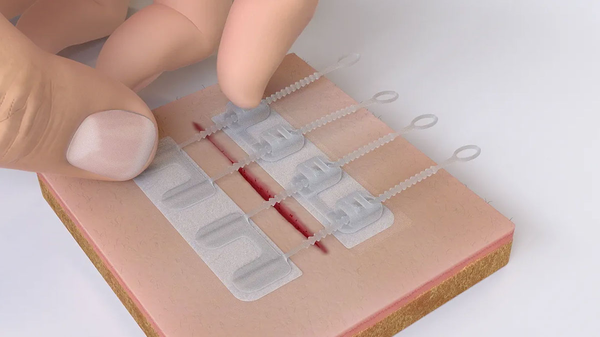ZipStitch - Close Wounds Without Stitches