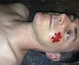 Jigsaw Puzzle Piece Prosthetic