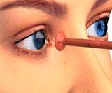 OptiWand Pincher Contact Lens Insertion & Removal Tool