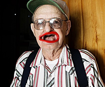 Hyperlip Prosthetic Lips Hyperlip Prosthetic Lips
