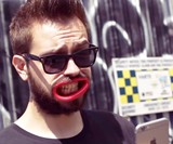 Hyperlip Prosthetic Lips