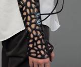 Osteoid - 3D Printed Ultrasound Cast