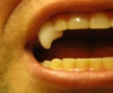 Moldable Plastic