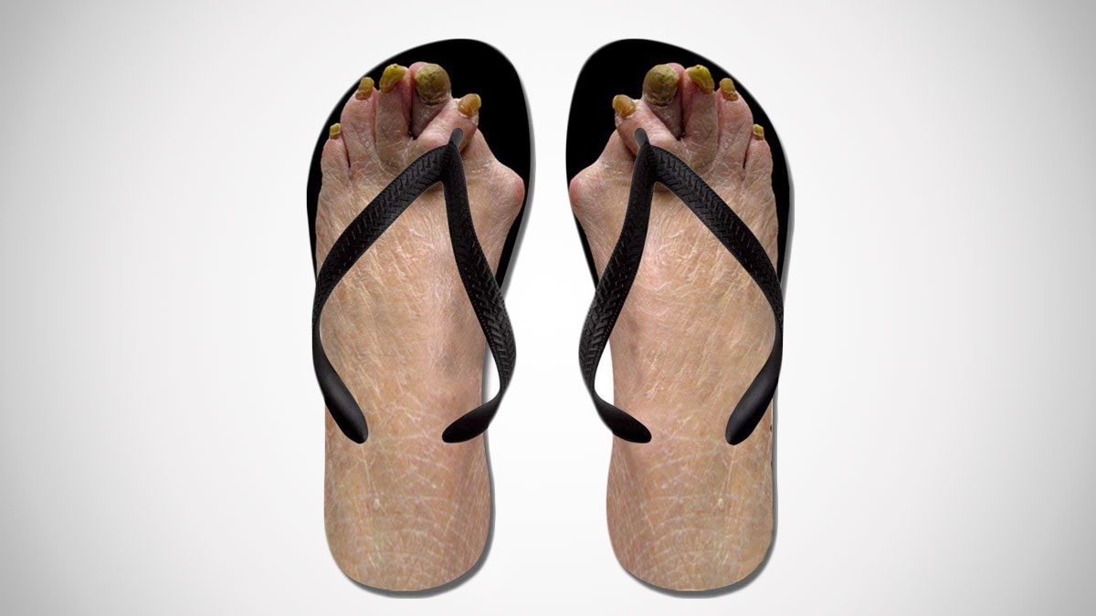 Ugly Feet Flip Flops Ugly Feet Flip Flops