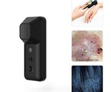 Skiary SK-3 Smartphone Dermatoscope