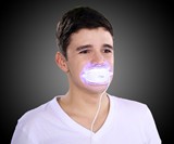 Teeth Whitening Accelerator