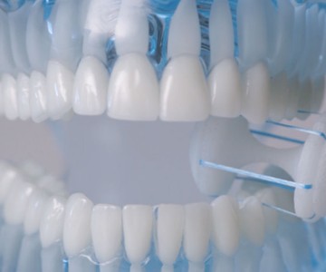 CrossFloss Hands-Free Flossing Tool