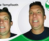 Temptooth Temporary Tooth Replacement Kit