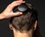 NextMind - Control Technology with Your Brainwaves