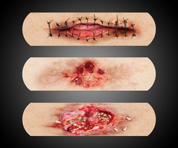 Boo-Boos Gory Bandages Boo-Boos Gory Bandages